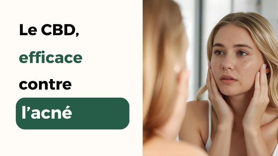 Le CBD est efficace contre l'acné : explications et solutions topiques ou internes